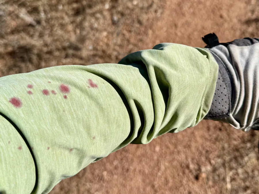 Spots of blood appear on a shirt sleeve