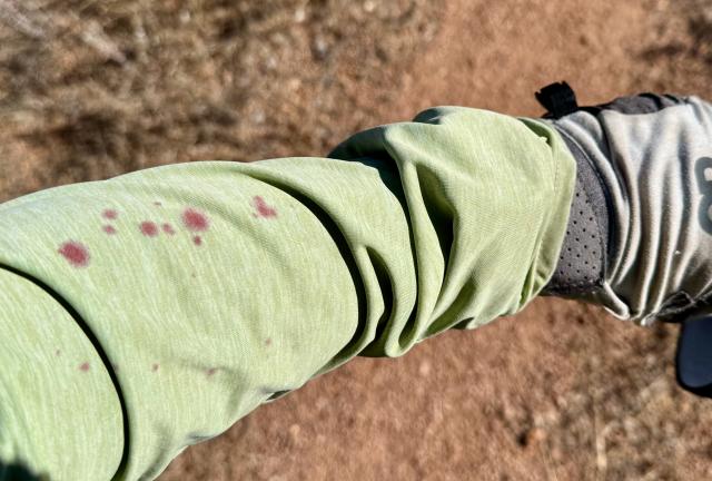 Spots of blood appear on a shirt sleeve